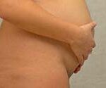 PAIN-FREE BIRTH