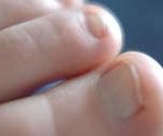 TAKING CARE OF YOUR TOES