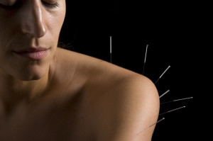 Shoulder acupuncture
